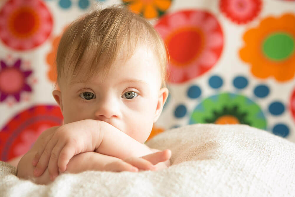 Tüp Bebek Tedavisinde Down Sendrom Riski